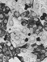 Detection and Quantification of African Swine Fever Virus in MA-104 Cells