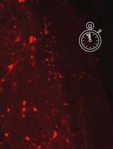 A Time Duration Discrimination Task for the Study of Elapsed Time Processing in Rats