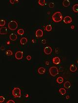 Analysis of TORC1-body Formation in Budding Yeast