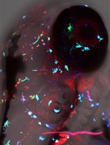 Brain-localized and Intravenous Microinjections in the Larval Zebrafish to Assess Innate Immune Response