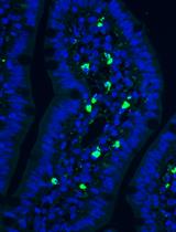 Using the Cecal Ligation and Puncture Model of Sepsis to Induce Rats to Multiple Organ Dysfunction