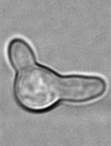 Single Cell Analysis and Sorting of <em>Aspergillus fumigatus</em> by Flow Cytometry