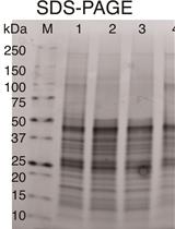 Quantitative Characterization of the Amount and Length of (1,3)-β-D-glucan for Functional and Mechanistic Analysis of Fungal (1,3)-β-D-glucan Synthase