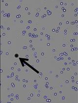 Optimized Recombinant Production of Secreted Proteins Using Human Embryonic Kidney (HEK293) Cells Grown in Suspension
