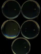 Assessing Swarming of Aerobic Bacteria from Human Fecal Matter