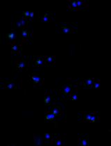 Click Chemistry for Imaging in-situ Protein Palmitoylation during the Asexual Stages of Plasmodium falciparum