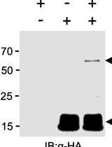 Characterising Plant Deubiquitinases with in vitro Activity-based Labelling and Ubiquitin Chain Disassembly Assays