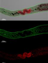 Parasitemia Evaluation in Mice Infected with Schistosoma mansoni
