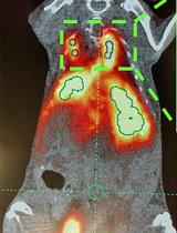 Surface Engineering and Multimodal Imaging of Multistage Delivery Vectors in Metastatic Breast Cancer