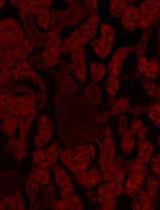 In vivo CD40 Silencing by siRNA Infusion in Rodents and Evaluation by Kidney Immunostaining