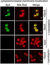 Tracking the Subcellular Localization of Surface Proteins in <em>Staphylococcus aureus</em> by Immunofluorescence Microscopy