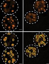 Analysis of Caenorhabditis elegans Sperm Number, Size, Activation, and Mitochondrial Content