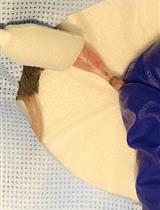 Muscle Cryoinjury and Quantification of Regenerating Myofibers in Mice