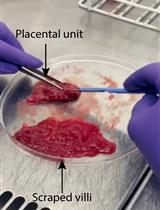 Isolation of First-Trimester and Full-term Human Placental Hofbauer Cells