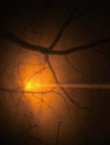 In vivo Fluorescence Imaging of Extracellular ATP in the  Mouse Cerebral Cortex with a Hybrid-type Optical Sensor