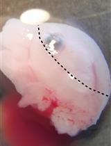 Enrichment of Vascular Fragments from Mouse Embryonic Brains for Endothelial Cell Analysis