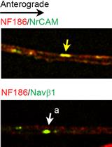 Dual Color, Live Imaging of Vesicular Transport in Axons of Cultured Sensory Neurons