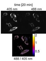 Monitoring Changes in the Oxidizing Milieu in the Endoplasmic Reticulum of Mammalian Cells Using HyPerER