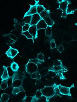 Visualization of Host Cell Kinase Activation by Viral Proteins Using GFP Fluorescence Complementation and Immunofluorescence Microscopy