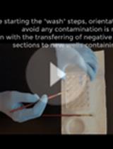 GFAP和TNF-α在小鼠下丘脑的免疫荧光