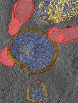 Electron Tomography to Study the Three-dimensional Structure of the Reovirus Egress Pathway in Mammalian Cells