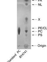 Yeast Lipid Extraction and Analysis by HPTLC