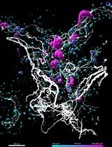 Optical Clearing and 3D Analysis Optimized for Mouse and Human Pancreata