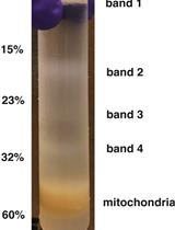用转位酶Oxa1L纯化HEK细胞线粒体核糖体