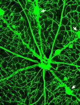A Genetically Engineered Mouse Model of Venous Anomaly and Retinal Angioma-like Vascular Malformation