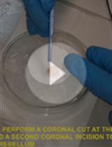 Cell-attached and Whole-cell Patch-clamp Recordings of Dopamine Neurons in the Substantia Nigra Pars Compacta of Mouse Brain Slices