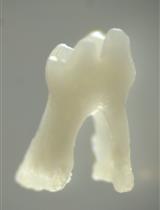 Isolation of Single Cells from Mouse Periodontal Ligament