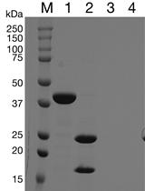 Synchronized Real-time Measurement of Sec-mediated Protein Translocation