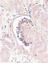 <em>In situ</em> Hybridization of miRNAs in Human Embryonic Kidney and Human Pluripotent Stem Cell-derived Kidney Organoids