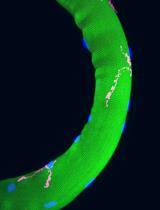 Isolation of Myofibres and Culture of Muscle Stem Cells from Adult Zebrafish