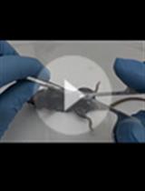 刺激后骨髓源性巨噬细胞中ASC炎症小体的显微检测 