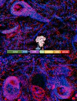 Measurement of LRRK2 Kinase Activity by Proximity Ligation Assay