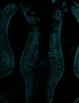 Isolation of Nasal Brush Cells for Single-cell Preparations