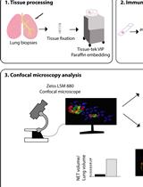 Identification and Quantitation of Neutrophil Extracellular Traps in Human Tissue Sections