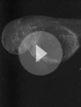 Zebrafish Embryos as a Predictive Animal Model to Study Nanoparticle Behavior in vivo