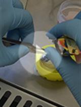 Isolation, Culture, and Identification of Primary Müller Cells from Human Retina