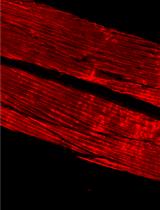 Phalloidin Staining of Actin Filaments for Visualization of Muscle Fibers in Caenorhabditis elegans 