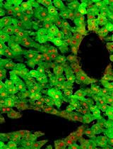 Transient yet Robust Expression of Proteins in the Mouse Liver via Intravenous Injection of Lipid Nanoparticle-encapsulated Nucleoside-modified mRNA