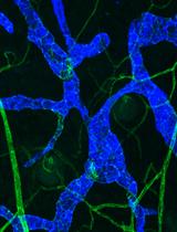 Whole-mount Immunohistochemistry to Visualize Mouse Embryonic Dermal Lymphatic Vasculature