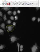 MRPL12和Nrf2在HK2细胞中的联合免疫荧光研究