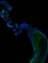 Collection of in vivo Capacitated Sperm from Different Locations Along the Reproductive Tract of Time-Mated Female Mice by Microdissection