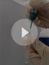 Isolation and Phospholipid Enrichment of Muscle Mitochondria and Mitoplasts