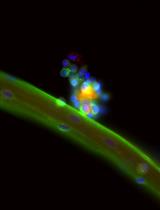 靶向小鼠卫星细胞中长链非编码 RNA 的表达