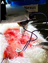 Cortical Laminar Recording of Multi-unit Response to Distal Forelimb Electrical Stimulation in Rats