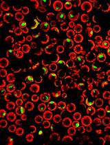 Preparation and Transfection of <i>Populus tomentosa</i> Mesophyll Protoplasts