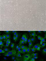 Isolation of Primary Leydig Cells from Murine Testis